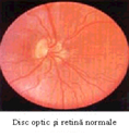 disc optic si retina normale.gif