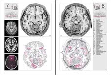 Typical pages from the printed atlas.