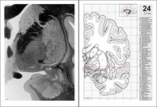 Typical pages from the printed atlas.