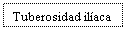Text Box: Tuberosidad ilaca