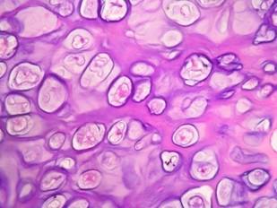 Gl parotida H-E 5, ob 40X