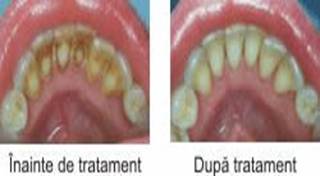 Description: tratdetart
